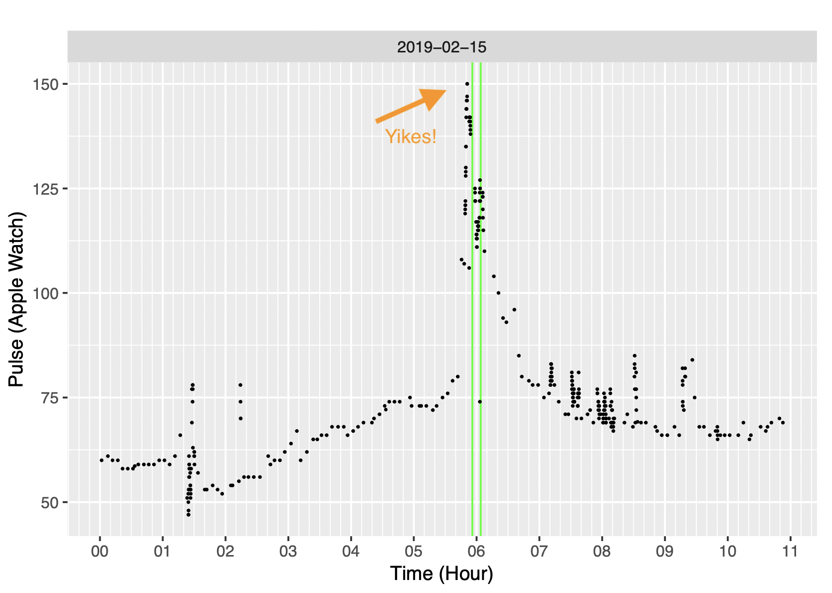 Another view of heart rate with arrow pointing to pulse of 150